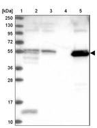 Lane 1: Marker [kDa] 250, 130, 95, 72, 55, 36, 28, 17, 10_br/_Lane 2: Human cell line RT-4_br/_Lane 3: Human cell line U-251MG sp_br/_Lane 4: Human plasma (IgG/HSA depleted)_br/_Lane 5: Human liver tissue