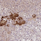 Immunohistochemical staining of human adrenal gland shows high expression.