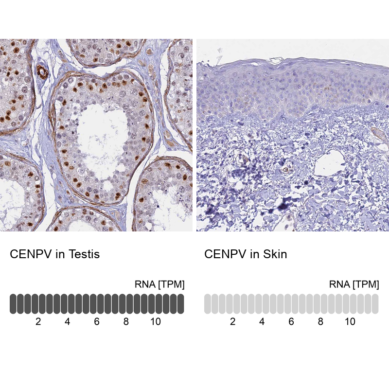 Anti-CENPV Antibody