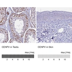Anti-CENPV Antibody