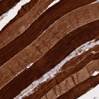 Immunohistochemical staining of human skeletal muscle shows moderate to strong cytoplasmic positivity in myocytes.