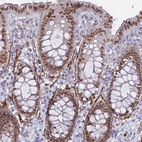 Immunohistochemical staining of human gastrointestinal shows moderate to strong nuclear positivity in glandular cells.