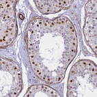 Immunohistochemical staining of human testis shows moderate to strong nuclear positivity in cells in seminiferous ducts.