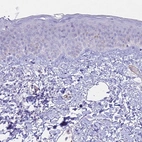 Immunohistochemical staining of human skin shows no positivity in squamous epithelial cells as expected.
