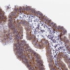 Anti-B9D2 Antibody
