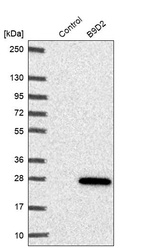 Western blot analysis in control (vector only transfected HEK293T lysate) and B9D2 over-expression lysate (Co-expressed with a C-terminal myc-DDK tag (~3.1 kDa) in mammalian HEK293T cells, LY410782).