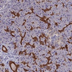Anti-WDR6 Antibody