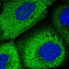 Immunofluorescent staining of human cell line A-431 shows localization to cytosol.