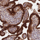 Anti-RPIA Antibody