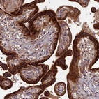Anti-RPIA Antibody