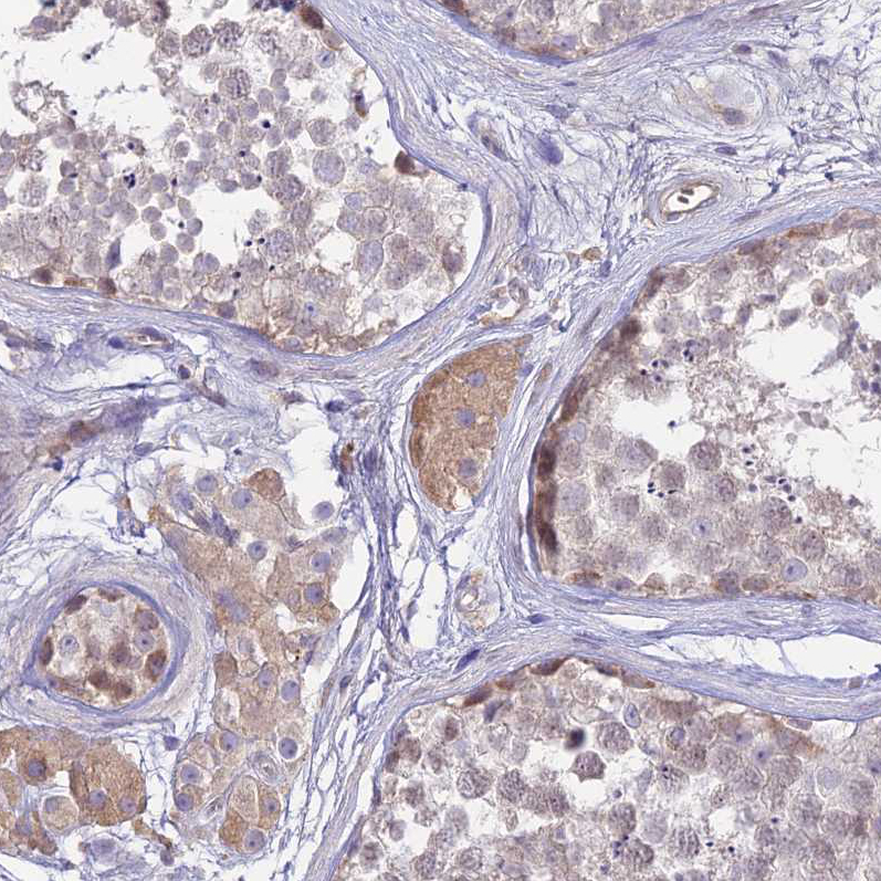 Anti-NLRP9 Antibody