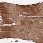 Immunohistochemical staining of human skeletal muscle shows strong cytoplasmic positivity in myocytes.