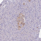 Immunohistochemical staining of human pancreas shows strong cytoplasmic positivity in islets of Langerhans.