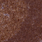 Immunohistochemical staining of human tonsil shows strong cytoplasmic positivity in germinal and non-germinal center cells.
