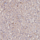 Immunohistochemical staining of human liver shows no positivity in hepatocytes as expected.