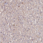 Immunohistochemical staining of human liver shows no positivity in hepatocytes as expected.