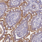 Immunohistochemical staining of human small intestine shows strong cytoplasmic positivity in glandular cells.