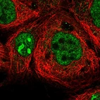 Immunofluorescent staining of human cell line A-431 shows localization to nucleoplasm & nucleoli.