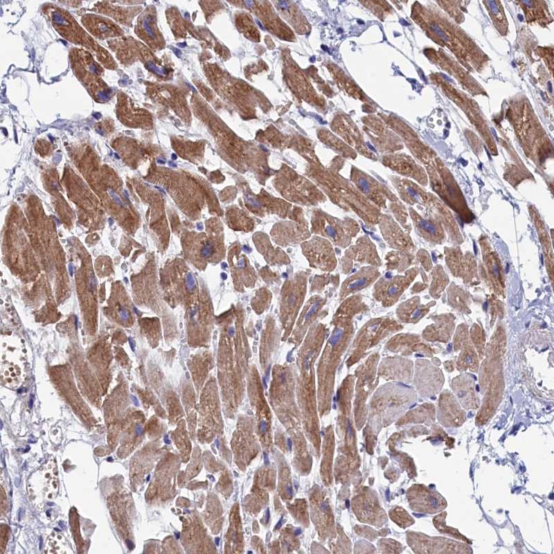 Anti-WDR83 Antibody
