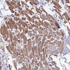 Anti-WDR83 Antibody