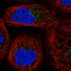 Immunofluorescent staining of human cell line A-431 shows localization to vesicles.