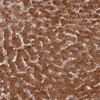 Anti-ASPDH Antibody