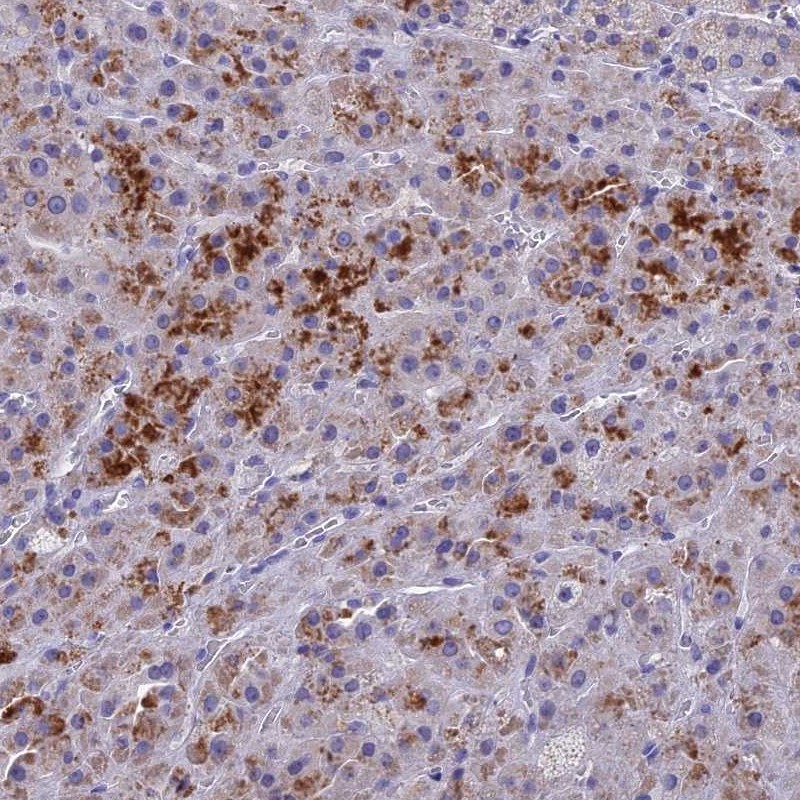 Anti-BTBD19 Antibody