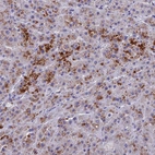 Anti-BTBD19 Antibody