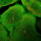 Immunofluorescent staining of human cell line A-431 shows localization to nucleoplasm, plasma membrane, cytosol & centrosome.