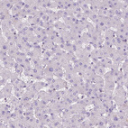 Immunohistochemical staining of human liver shows no positivity in hepatocytes as expected.