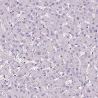 Immunohistochemical staining of human liver shows no positivity in hepatocytes as expected.