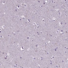 Immunohistochemical staining of human cerebral cortex shows no positivity in neurons as expected.