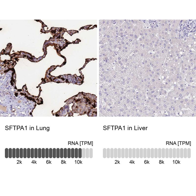 Anti-SFTPA1 Antibody