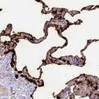 Immunohistochemical staining of human Lung shows strong cytoplasmic positivity in pneumocytes.