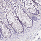 Immunohistochemical staining of human Rectum shows no positivity in glandular cells as expected.