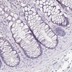 Immunohistochemical staining of human Rectum shows no positivity in glandular cells as expected.