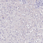 Immunohistochemical staining of human Liver shows no positivity in hepatocytes as expected.