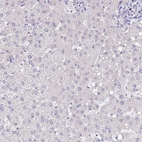 Immunohistochemical staining of human Liver shows no positivity in hepatocytes as expected.