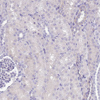 Immunohistochemical staining of human Kidney shows no positivity in cells in tubules as expected.