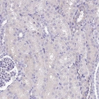 Immunohistochemical staining of human Kidney shows no positivity in cells in tubules as expected.