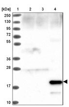 Lane 1: Marker [kDa] 250, 130, 95, 72, 55, 36, 28, 17, 10_br/_Lane 2: Human cell line RT-4_br/_Lane 3: Human cell line U-251 MG_br/_Lane 4: Human plasma