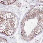 Anti-RARS2 Antibody