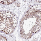 Anti-RARS2 Antibody