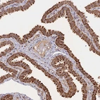 Immunohistochemical staining of human fallopian tube shows strong granular cytoplasmic positivity in glandular cells.