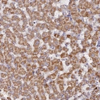 Immunohistochemical staining of human liver shows strong granular cytoplasmic positivity in hepatocytes.