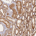 Immunohistochemical staining of human kidney shows strong granular cytoplasmic positivity in cells in tubules.