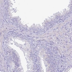 Immunohistochemical staining of human prostate shows no positivity in glandular cells as expected.
