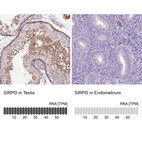 Anti-SIRPD Antibody