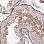 Immunohistochemical staining of human testis shows high expression.