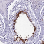 Immunohistochemical staining of human testis shows strong cytoplasmic positivity in cells in seminiferous ducts.
